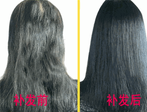 韓美黛織發(fā)補(bǔ)發(fā)加盟