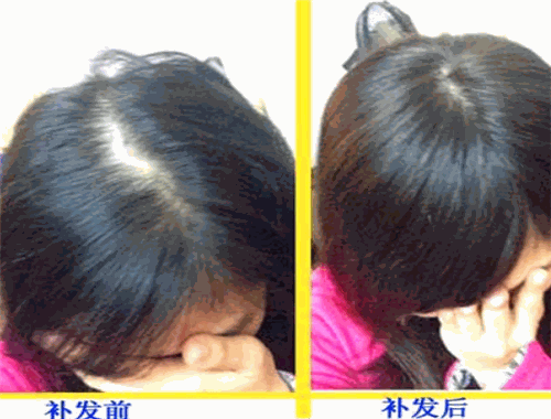 韓美黛織發(fā)補(bǔ)發(fā)