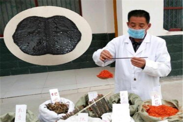 椎風益土家土方黑膏加盟