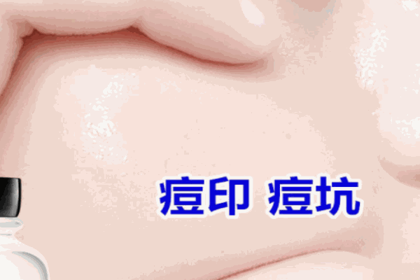 清容世家祛痘加盟