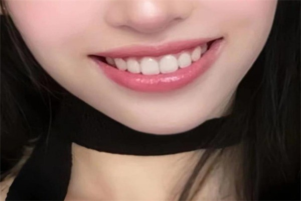 玉蘭貴人美牙加盟