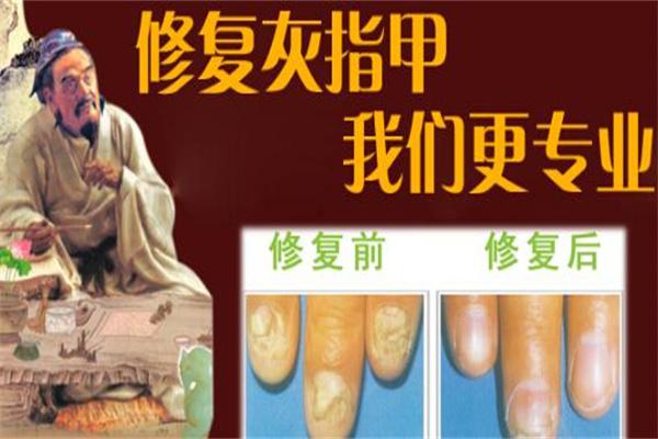 田氏甲膚康灰指甲加盟
