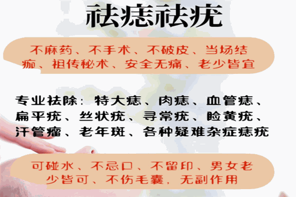 痣運(yùn)星加盟