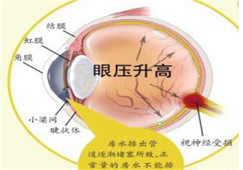 艾草芳華視力修復(fù)加盟