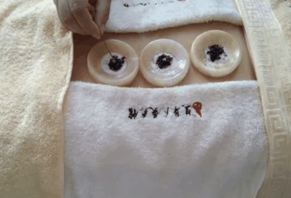 鋪姜灸