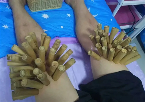 吃飽瘦竹罐減肥加盟