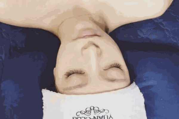 韓醫(yī)生皮膚管理
