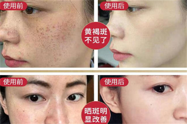斑美凈化妝品