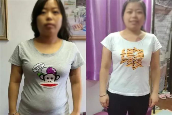 妙玥纖減肥加盟