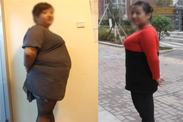 妙齡妃減肥加盟