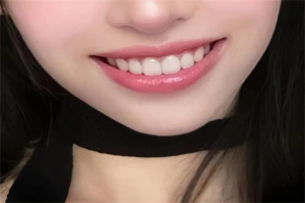 玉蘭貴人美牙